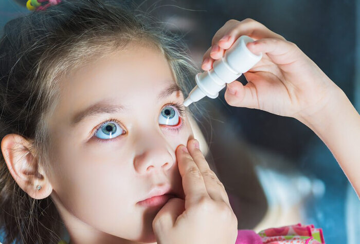 How to Treat Eye Infection in Kids: A Guide for Parents