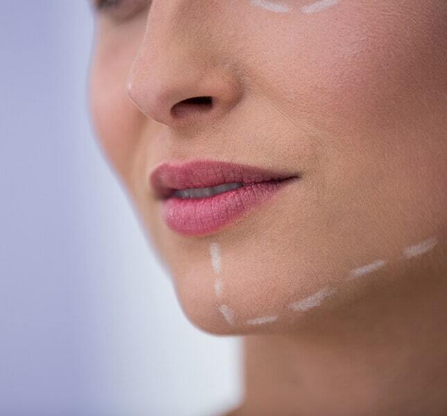 Chin Augmentation in Delhi | Chin Implant Surgery Cost – Dr Rajat Gupta