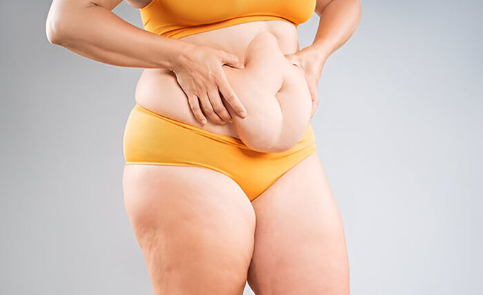 How to Choose the Best Surgeon for Tummy Tuck Surgery in India - WebHitList.com