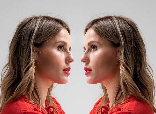 Rhinoplasty Surgery in Delhi | Nose Reshaping Cost - Dr Rajat Gupta